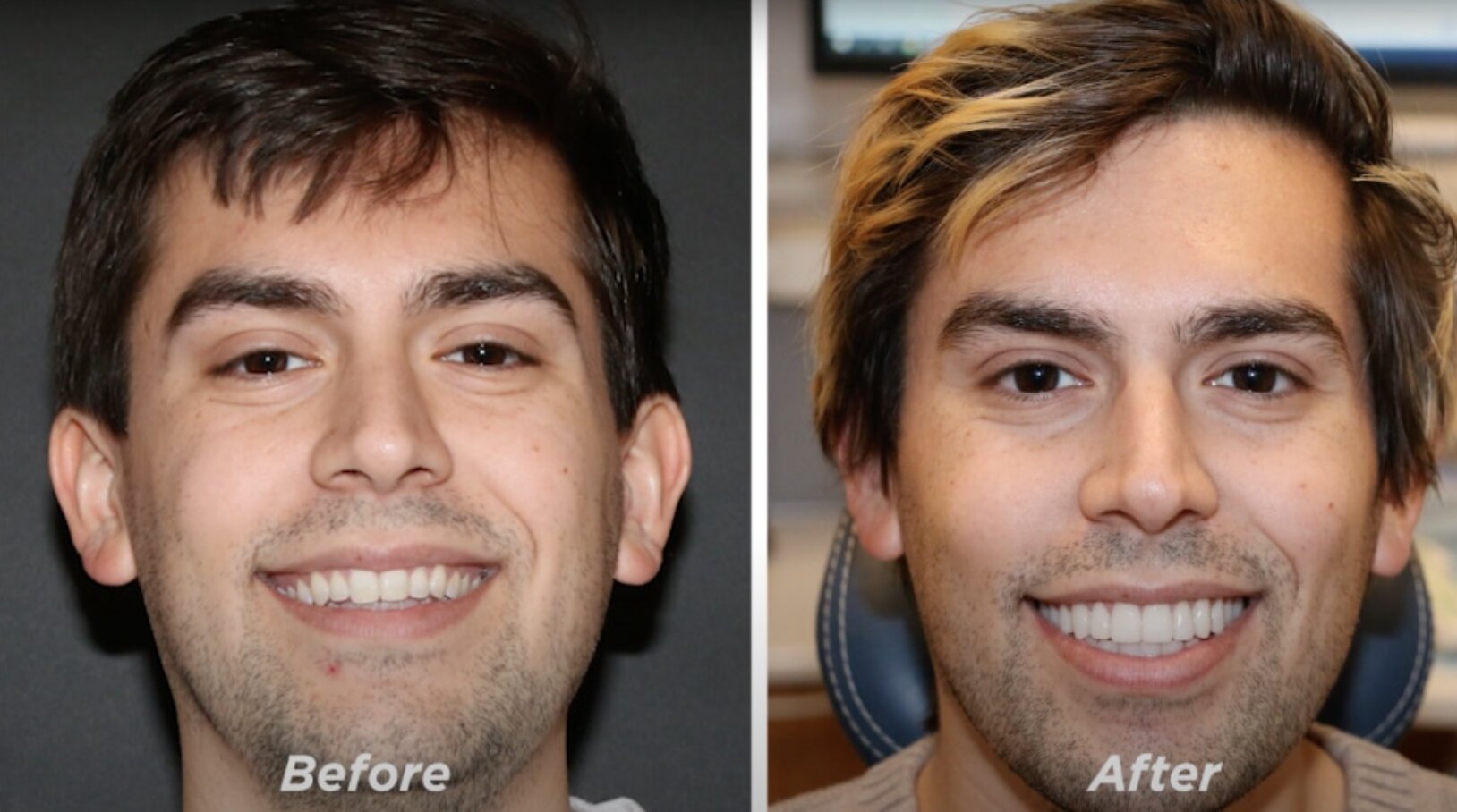 Smile Makeover Woburn 